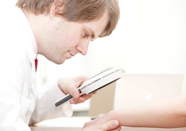 Diagnóstico da psoríase por un dermatólogo